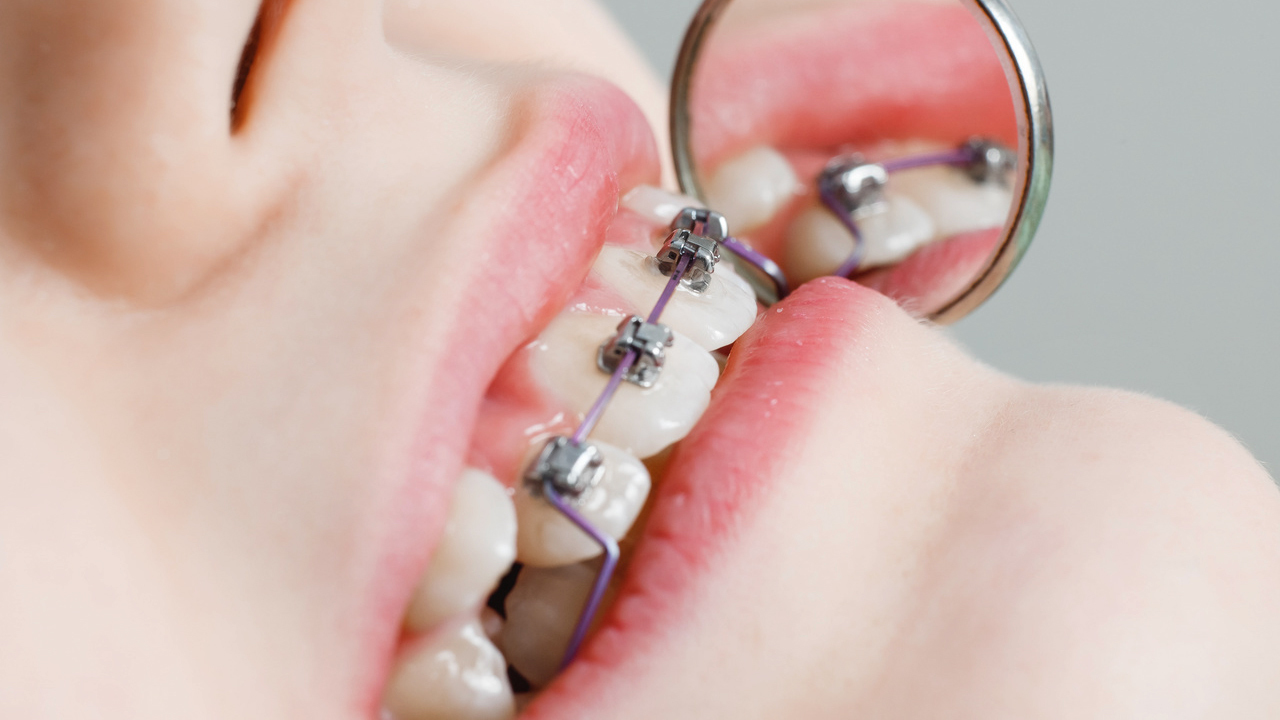 部分矯正について解説するページのリンク