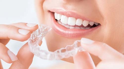 坂井の矯正歯科で人気の透明のマウスピースを装着する様子