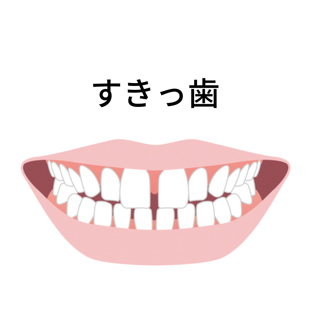 ＡＩの扱いで失敗のリスクが生じる