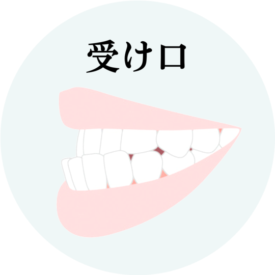 受け口・反対咬合の矯正 - 坂井矯正歯科相談室